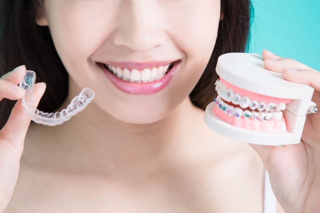 Invisalign - Who is Invisalign For