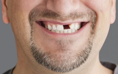 Dental Emergency in Ottawa? Don’t Wait – We’re Here When You Need Us!